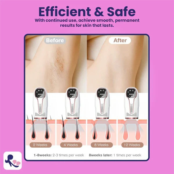 Premium IPL laser hair remover for women with 10 lakh flashes