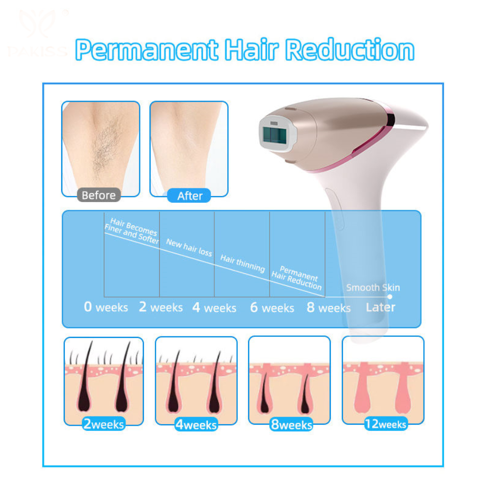 at home laser hair removal device for women Pakistan